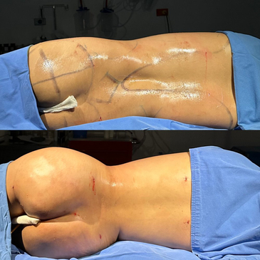 Slider image (3) Dr. Gabriel Sandoval - Plastic Surgeon in Mexico